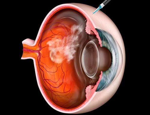 Injeções Intra-Vítreas